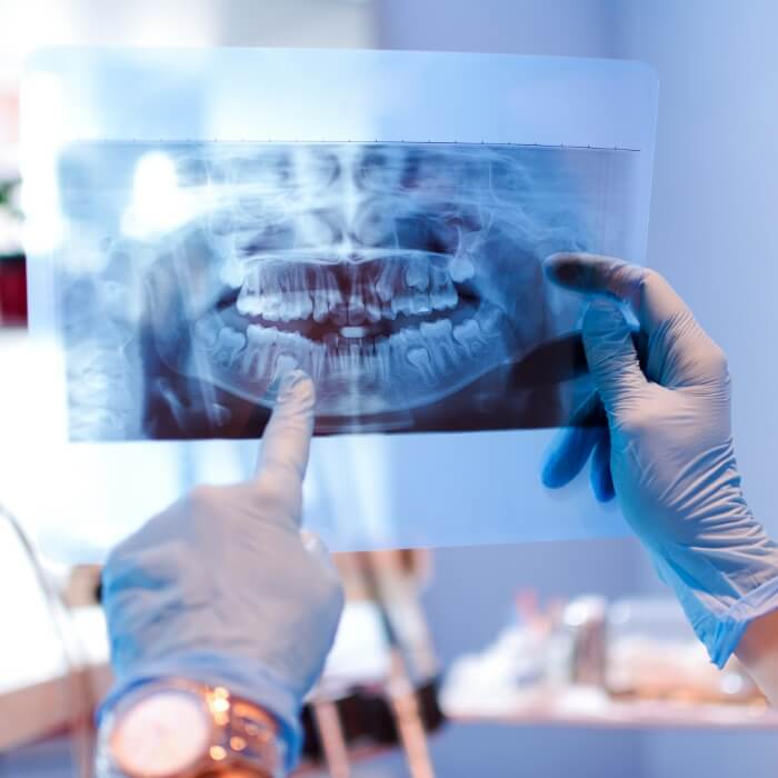 Dentist looking at digital dental x-rays