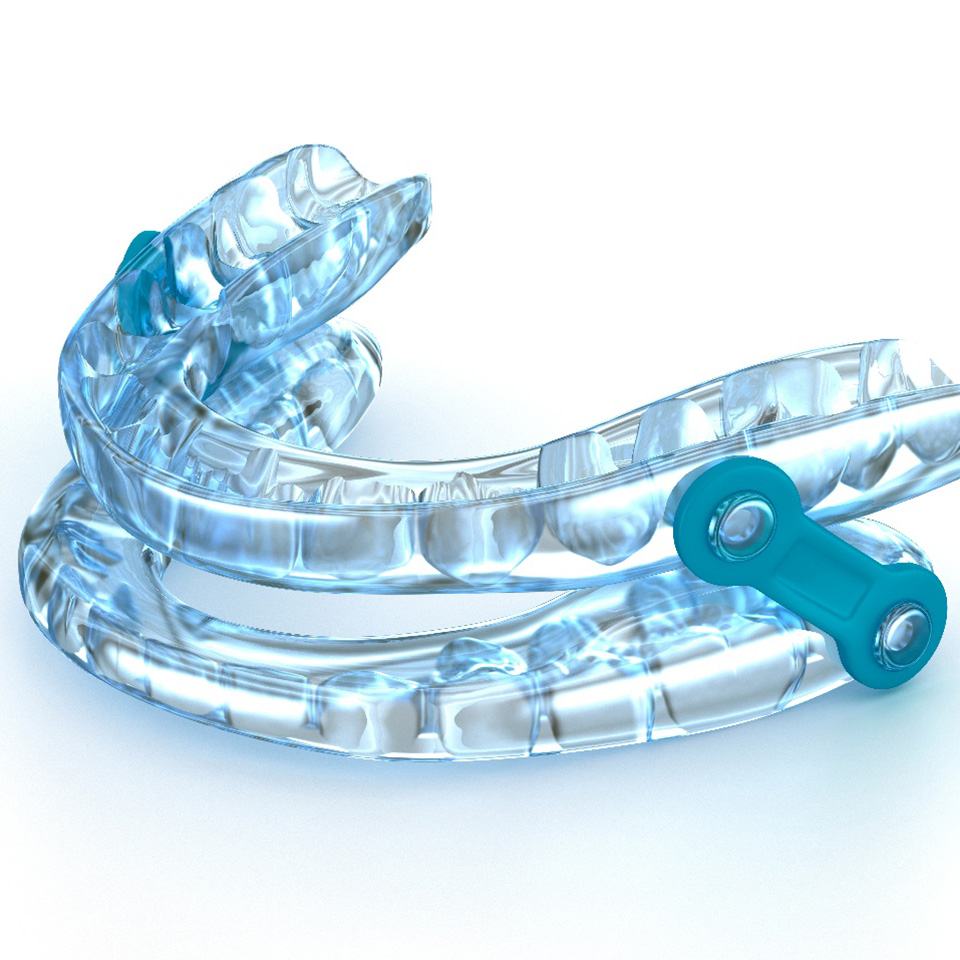 Oral appliance therapy for sleep apnea can help you get the rest you deserve