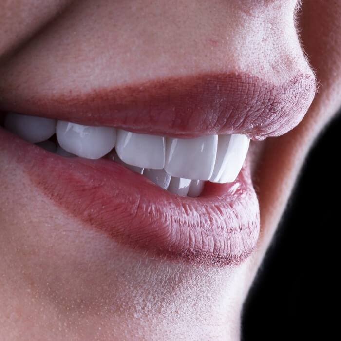 Closeup of flawless smile after cosmetic dental bonding