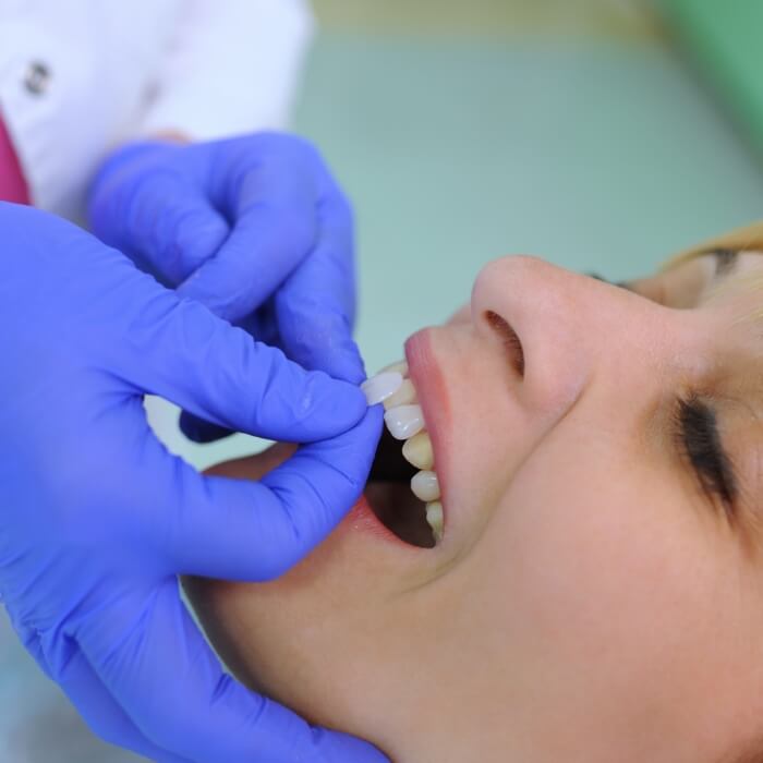 Dental patient receiving porcelain veneers