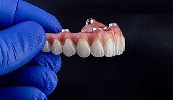 Implant dentures are more expensive than traditional dentures but pay for themselves over time