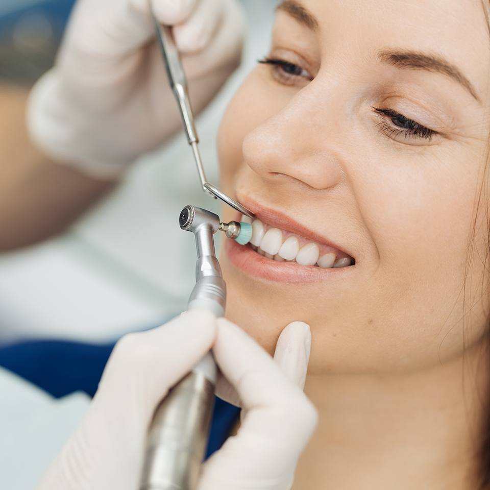 Dentist polishing a white filling for a patient