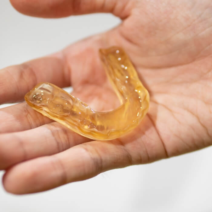 Hand holding a nightguard for bruxism