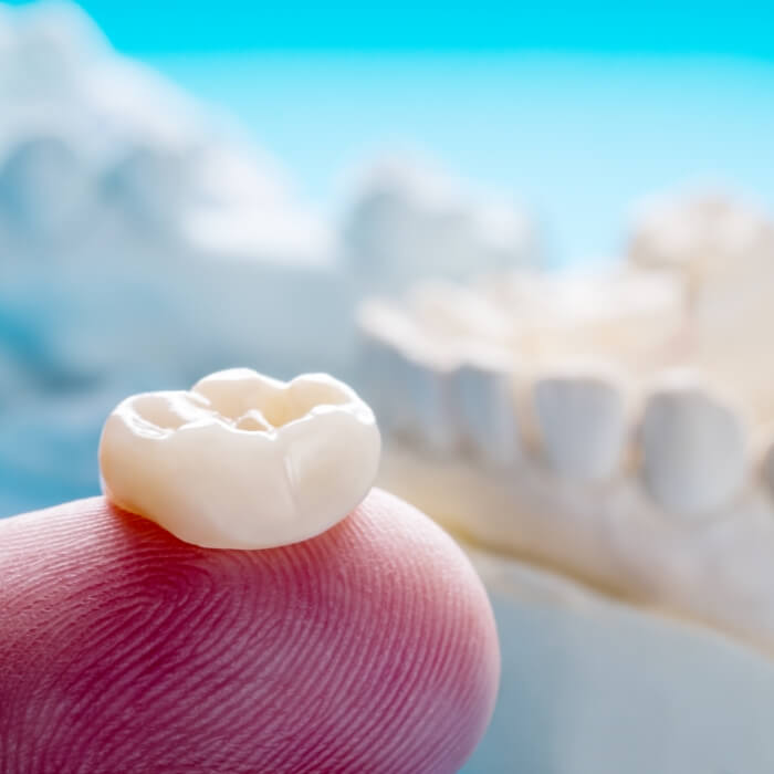 Dental crown on a fingertip