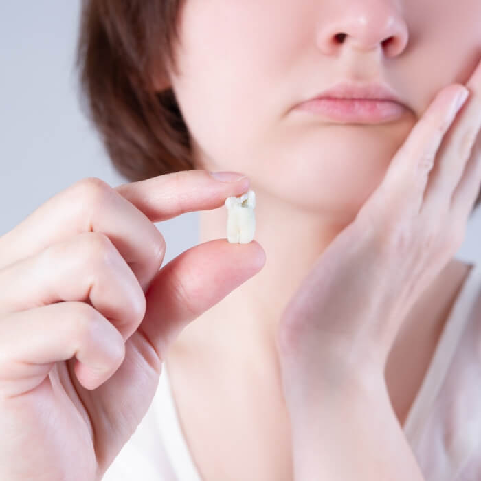 Woman holding extracted wisdom tooth