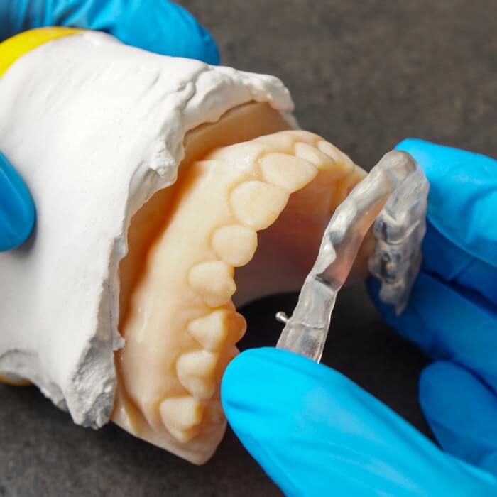 Dentist using smile model to craft a custom occlusal splint