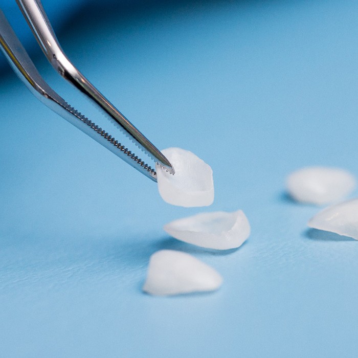 Close up of veneers