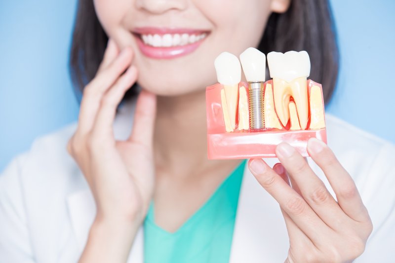 An implant dentist holding an implant model